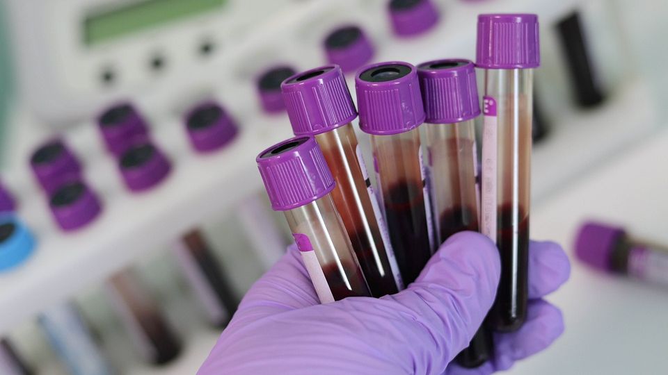 Alithea Genomics and partners to develop a first-of-a-kind pan-cancer blood test