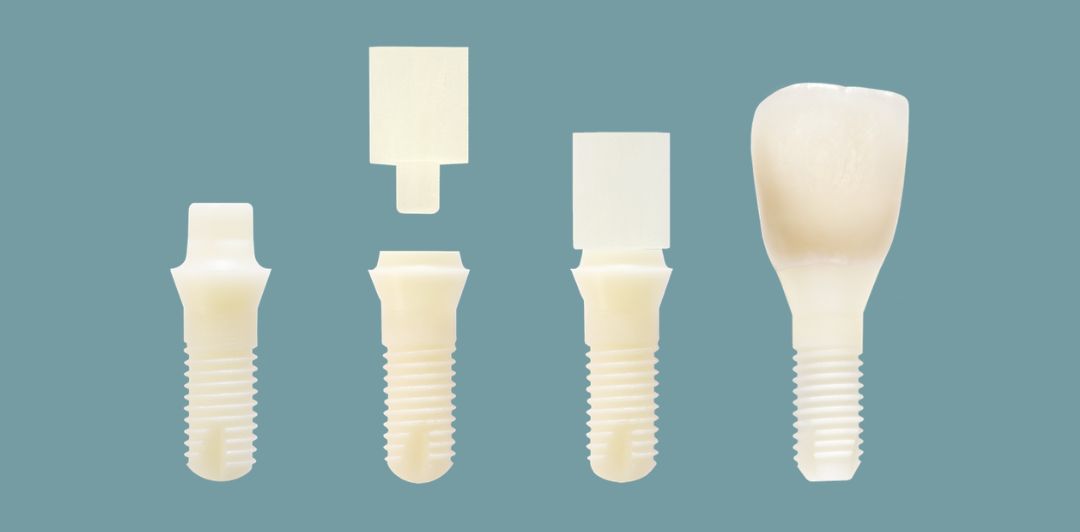 Zircon Medical Patent Zahnimplantat Sytem
