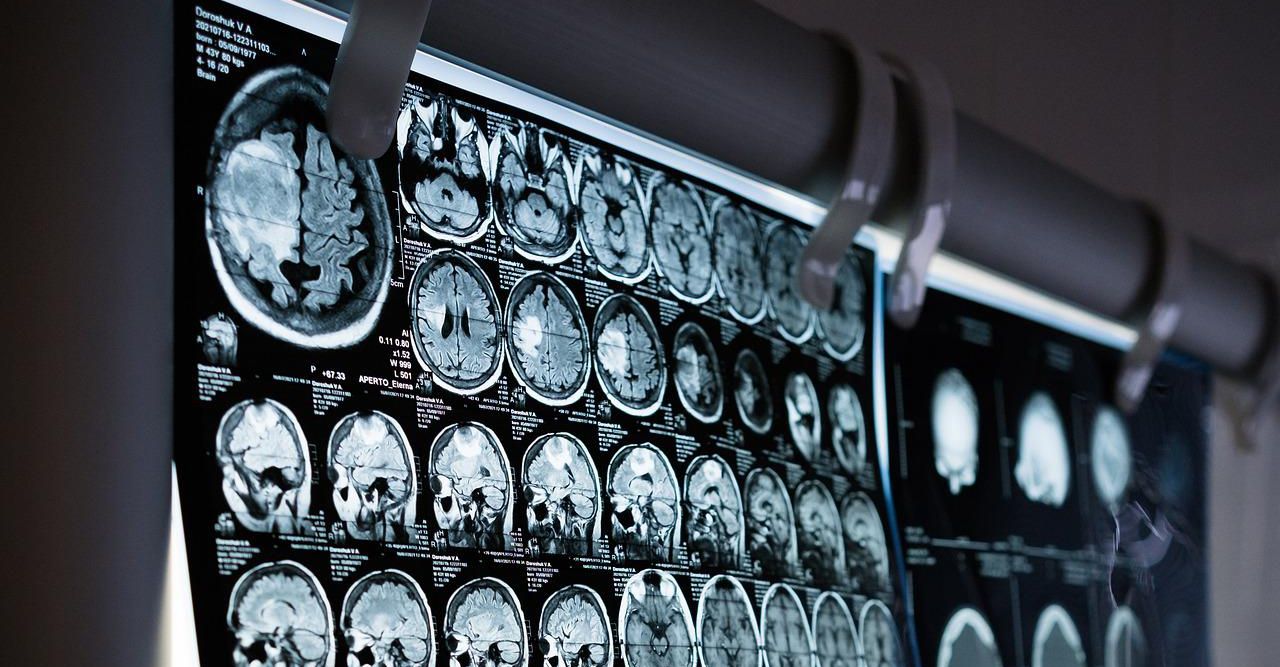 medical imaging brain